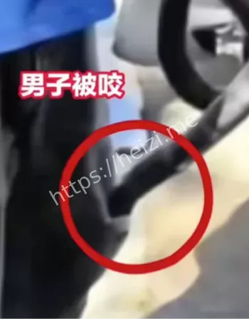 贵州男子被蛇咬